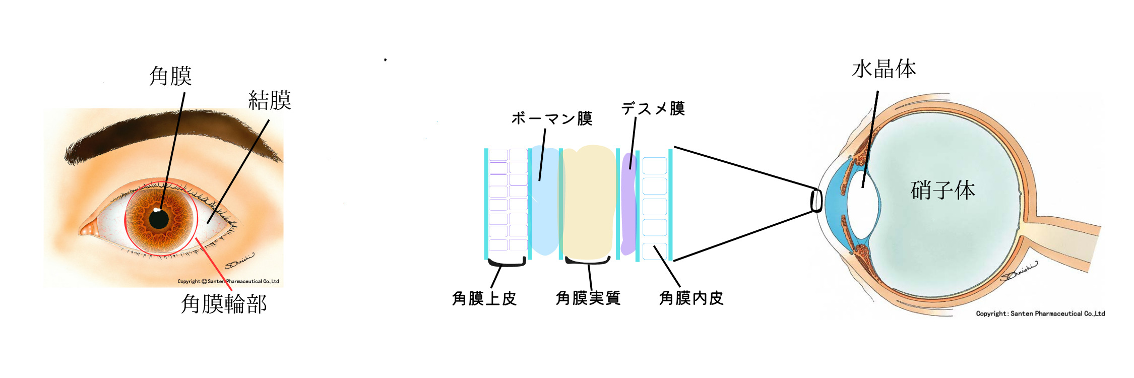 角膜剥離の治療法は何ですか?