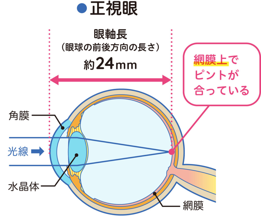 正視眼では光が網膜上で焦点を結ぶ