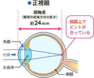 正視眼では光が網膜上で焦点を結ぶ